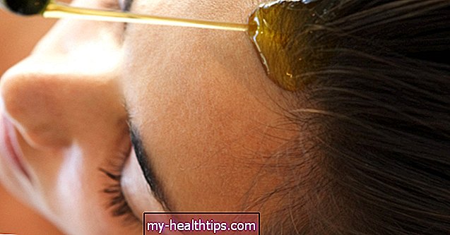 自宅で頭皮乾癬を自然に治療する
