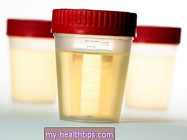 Test proteina u urinu