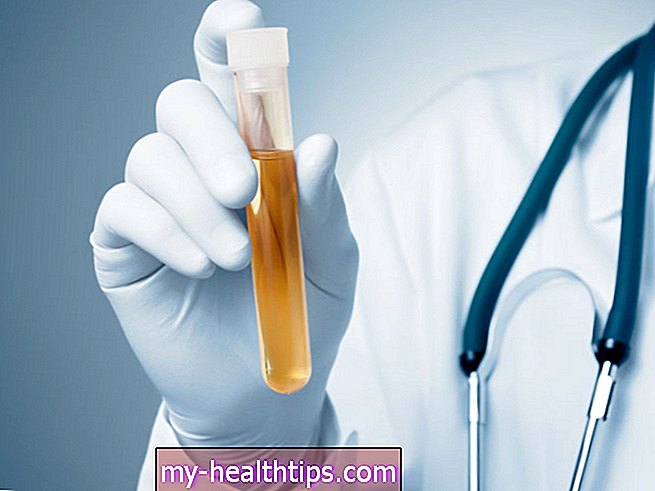 Natriumspiegel-Test im Urin