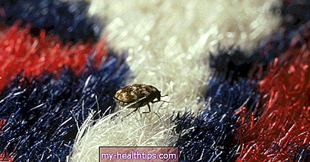 ¿Qué son los escarabajos de las alfombras y pueden lastimarte?
