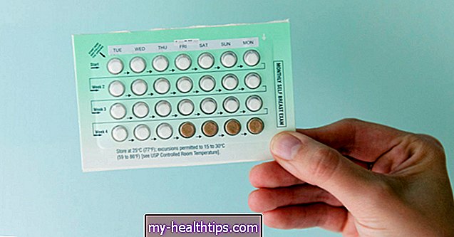 Kokia rizika imtis kontraceptinių priemonių nesąmoningai nėščia?