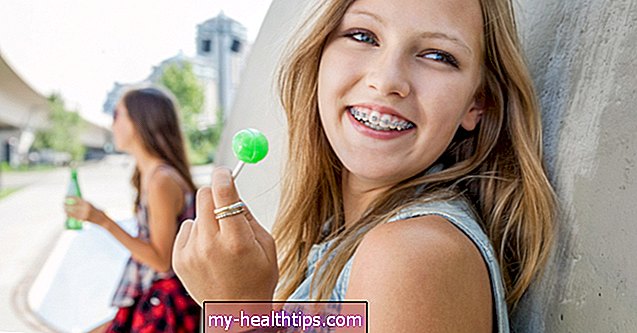 Qué causa los dientes torcidos y cómo enderezarlos