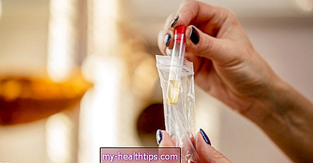 Što uzrokuje razrijeđeni urin u testovima na lijekove i kako ga spriječiti