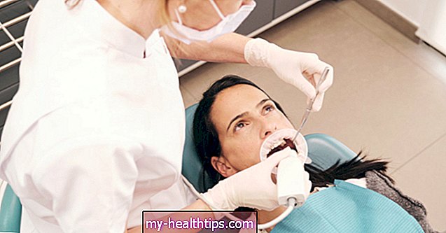 Was verursacht grüne Zähne und wie man sie behandelt