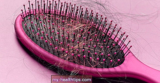 O que causa a perda de cabelo após a cirurgia?