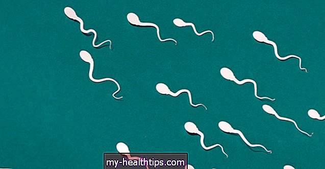Kas lemia mažą spermatozoidų kiekį ir kaip jis gydomas?