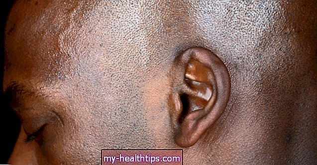 ¿Qué podría estar causando el crujido en su oído?