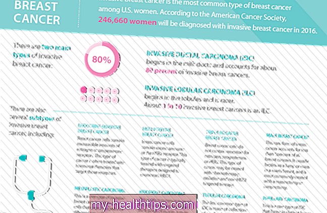 Was jede Frau über Brustkrebs wissen sollte