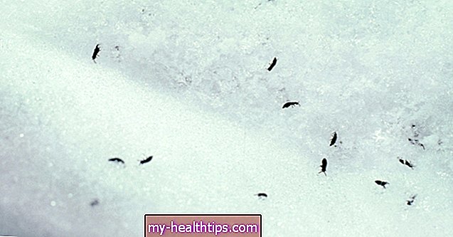 ¿Qué son exactamente las pulgas de las nieves y pican?