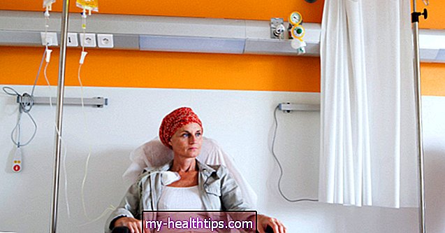 ¿Qué le sucede a su cuerpo durante la quimioterapia? 5 efectos secundarios comunes