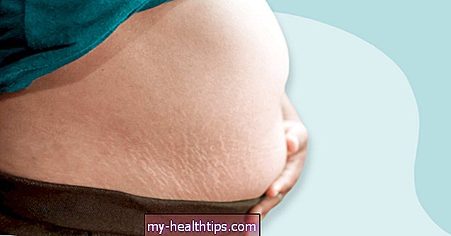 Was ist ein B-Bauch während der Schwangerschaft und warum passiert es?