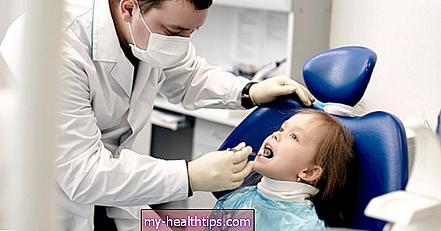 Co jsou Hutchinsonovy zuby? Viz Obrázky, Zjistěte příčiny, Léčba a další