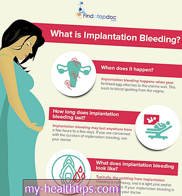 ¿Qué es el sangrado de implantación?