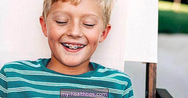 Apa Itu Terapi Bibir Bumper? Bisakah Itu Membuat Kawat Gigi Lebih Efektif?