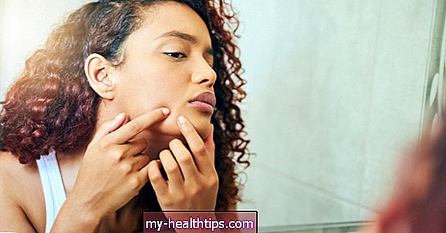 Ce este Pimple Pus și cum să îl tratați și să îl preveniți