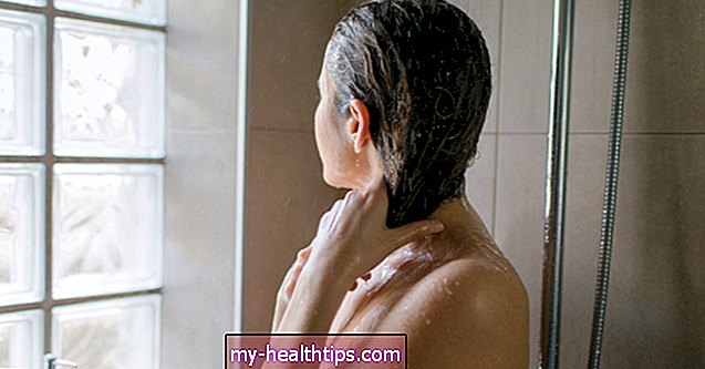 Kam naudojamas šampūnas su salicilo rūgštimi?