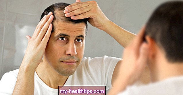 ¿Qué medicamentos pueden causar la caída del cabello y qué puede hacer al respecto?