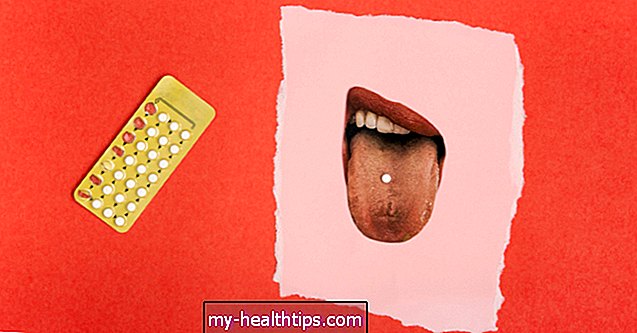 Ką daryti, jei praleidote vieną ar daugiau kontraceptinių tablečių