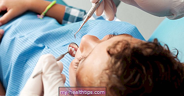 あなたの子供が虫歯を持っている場合に何をすべきか—そしてもっと防ぐ方法