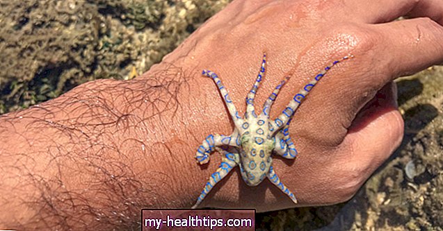 Što učiniti ako vas ugrize otrovna hobotnica s plavim prstenom