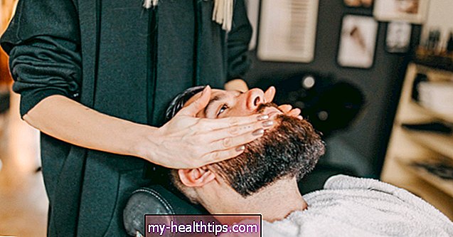 Ką reikia žinoti apie barzdos implantus