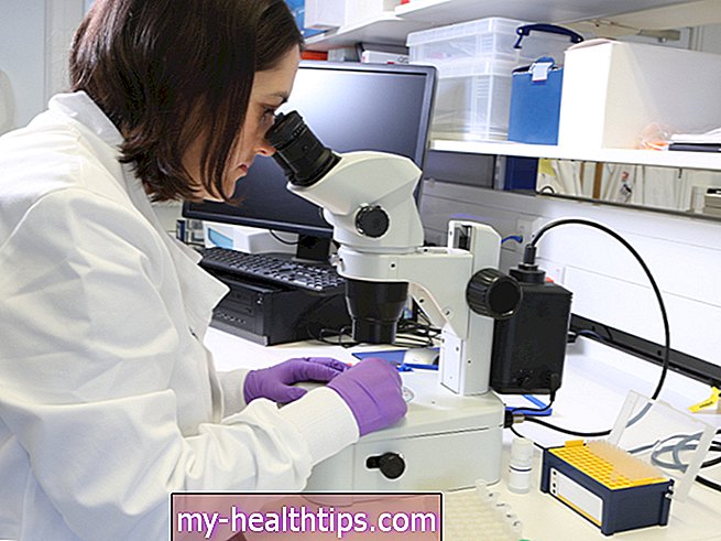 Qué debe saber sobre los ensayos clínicos para el linfoma de células del manto