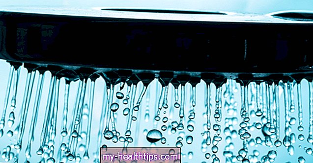 Qué debe saber sobre la terapia con agua fría