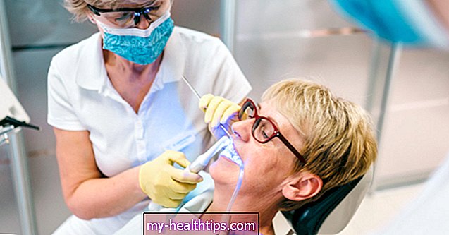 Ką reikia žinoti apie CEREC dantų vainikus