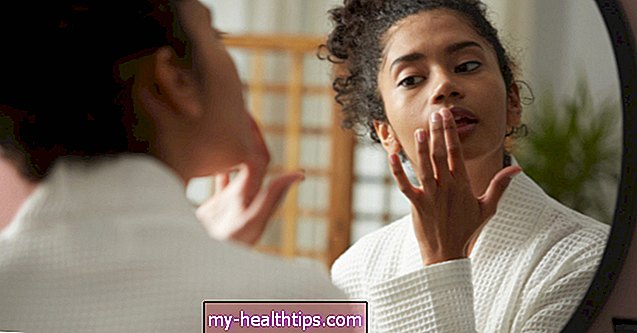 Mitä sinun pitäisi tietää huuliherpesistä raskauden aikana