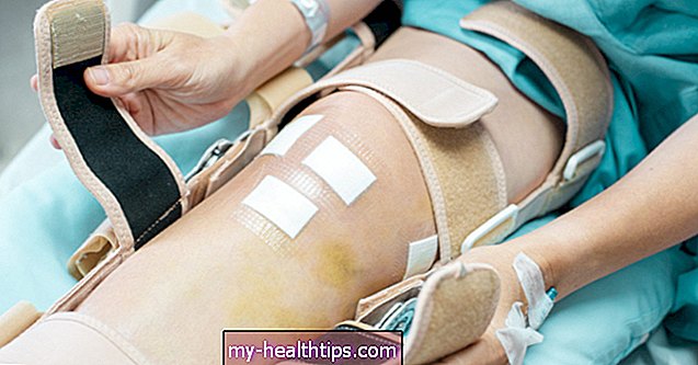 Co byste měli vědět o infekcích po výměně kolena