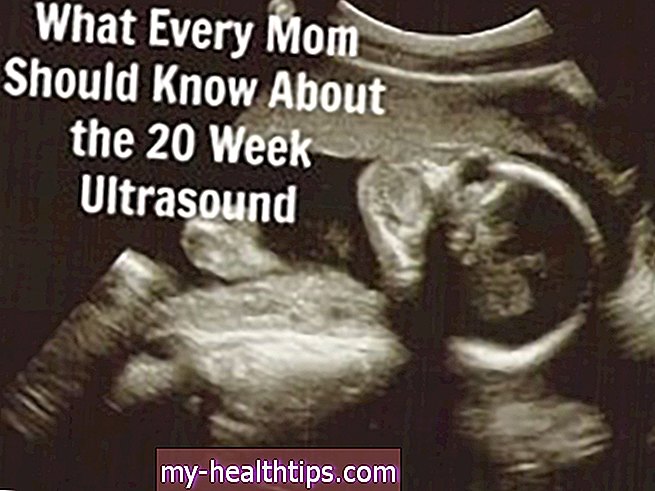 Ką turėtumėte žinoti apie anatomijos ultragarsą