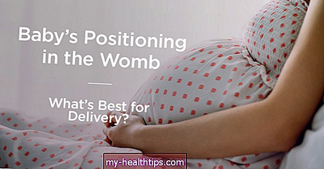Qué significa la posición de su bebé en el útero