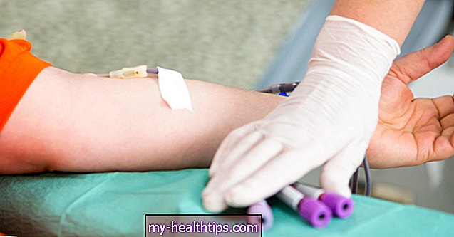 ¿Qué es un pH sanguíneo normal y qué lo hace cambiar?