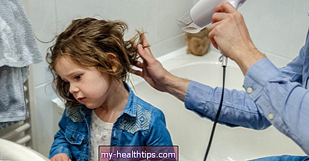 Ce cauzează căderea părului copilului meu și cum îl tratez?