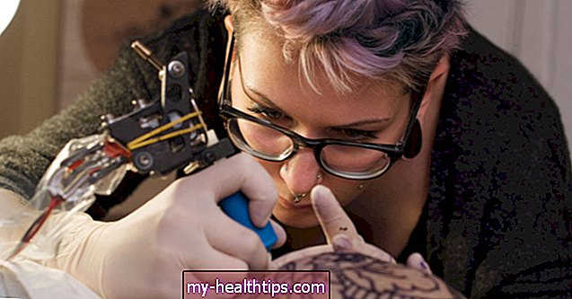 Каква је веза између келоида, ожиљака и тетоважа?