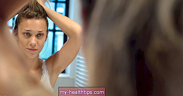 Zašto može doći do gubitka kose tijekom ili nakon trudnoće i što možete učiniti