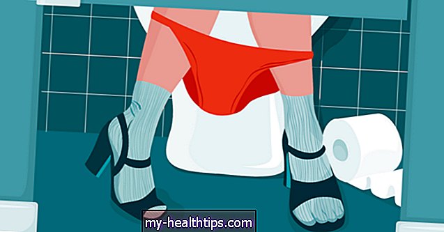 Warum ist Period Poop das Schlimmste? 10 Fragen beantwortet