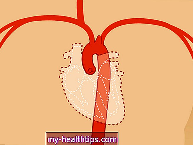 Silazna genitalna arterija