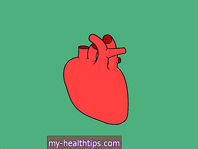 Вътрешна илиачна артерия (хипогастрална артерия)