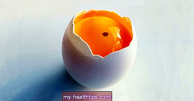 Sind Eier mit Blutflecken sicher zu essen?