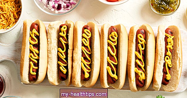Wie viele Kalorien enthält ein Hot Dog?