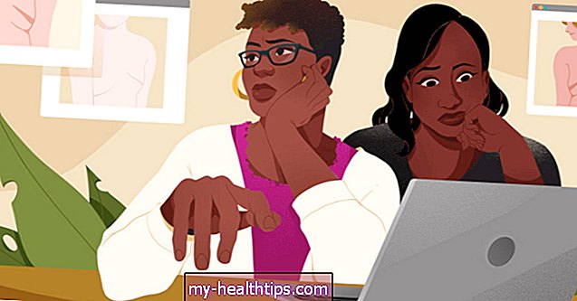 Por qué es importante la representación para las mujeres de color en la comunidad del cáncer de mama